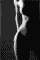 Erotic Women b/w 2